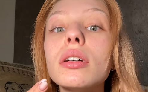 A Házasság első látásra Anastasiája videóban reagált az őt ért bántásokra! Kitálalt, miket mondanak neki, és elárulta, mi történt az arcbőrével: